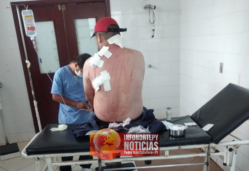 Brasileño sobrevive a un atentado en Capitán Bado