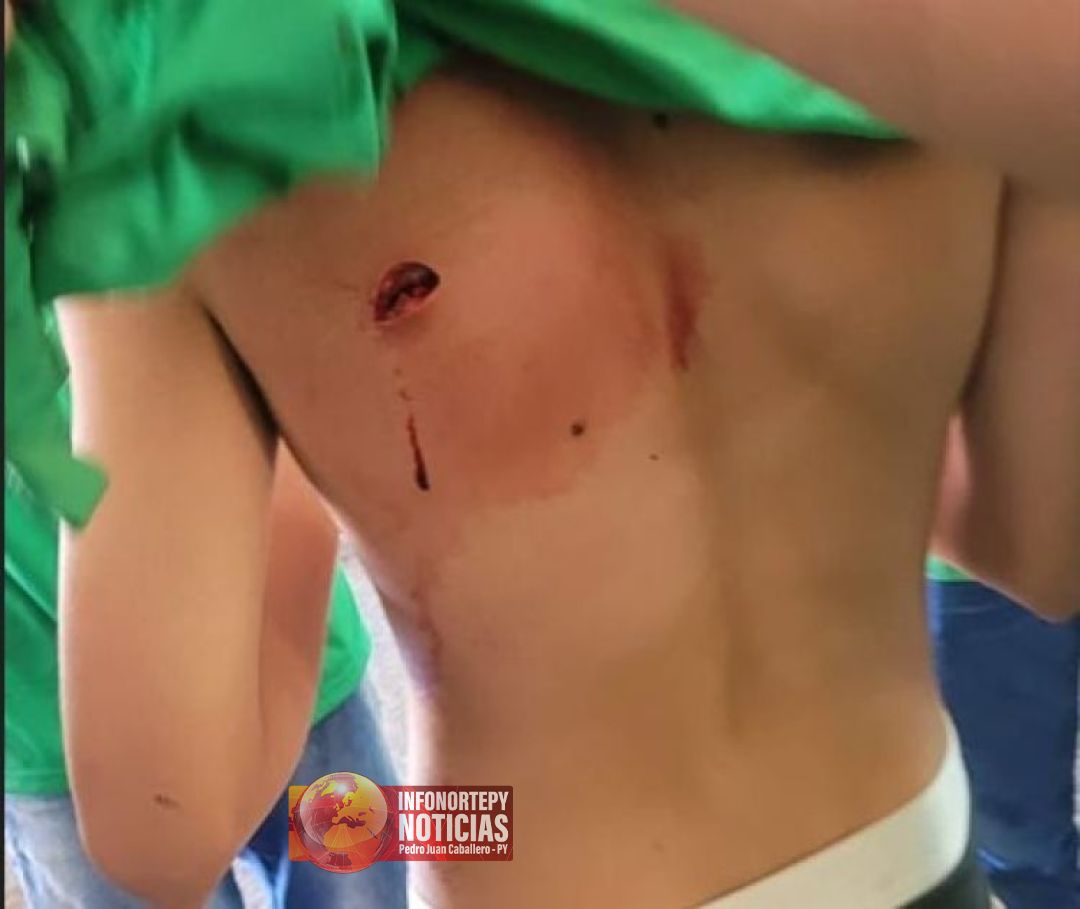Estudiante de escuela de Ponta Porã fue apuñalado tras pelea entre alumnos