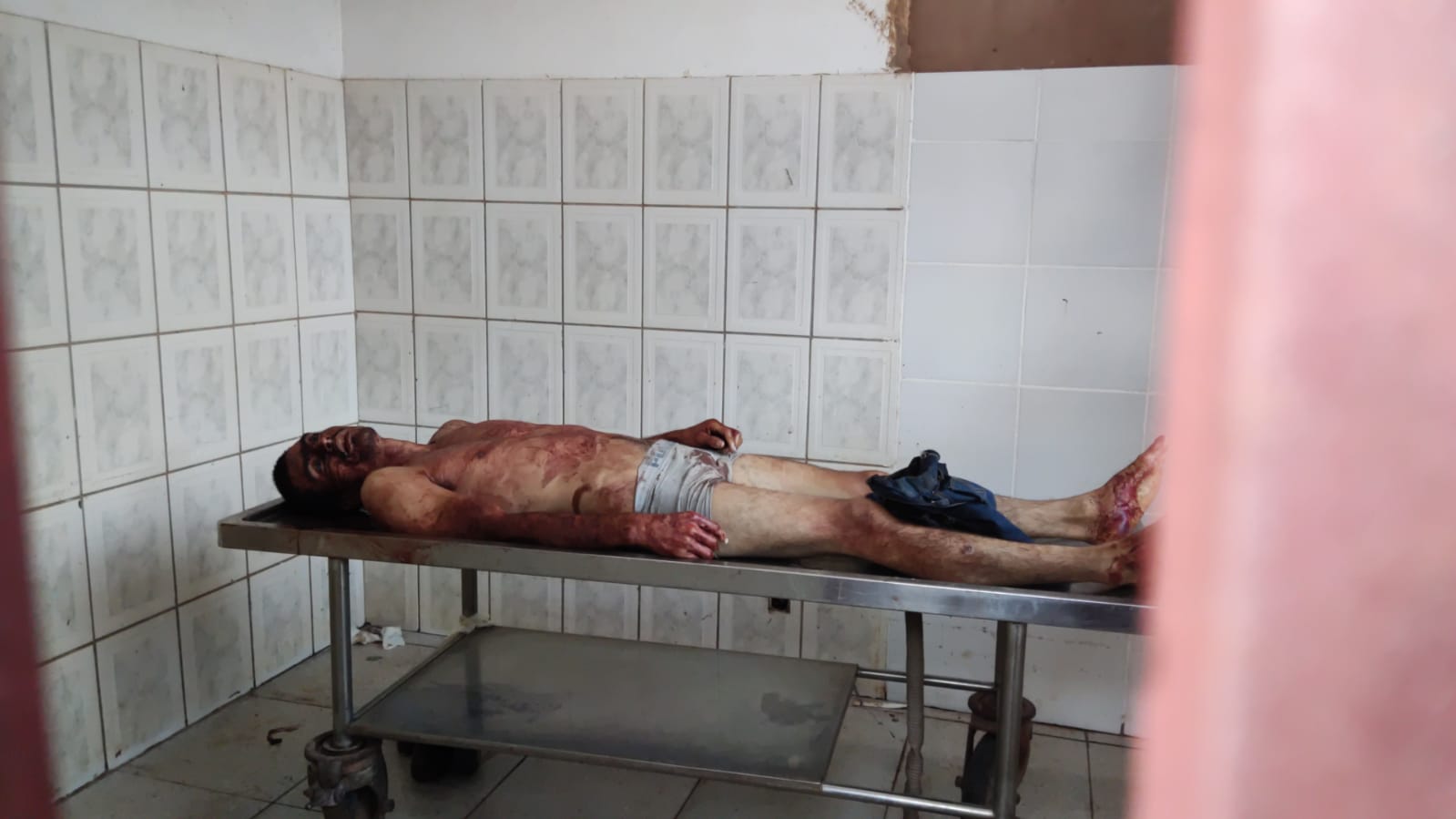 Un fallecido y un herido durante ataque de sicarios en Pedro Juan.