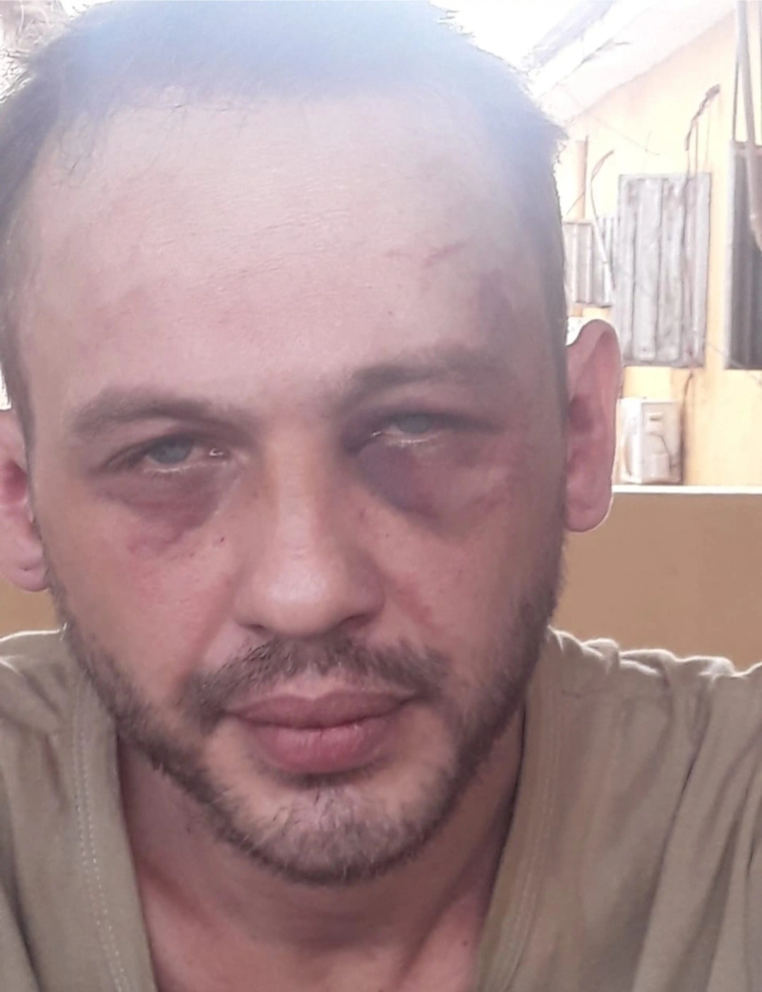 Denuncian brutal golpiza a un recluso en la cárcel de Pedro Juan