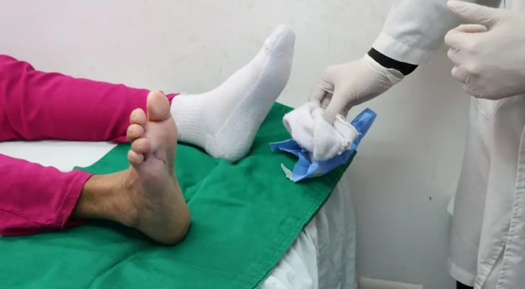 Clínicas: dan de alta a paciente con pie diabético tras innovador tratamiento con larvas