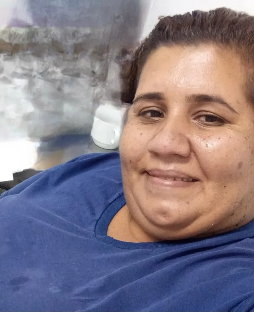 Fallece mujer en accidente de tránsito en Pedro Juan