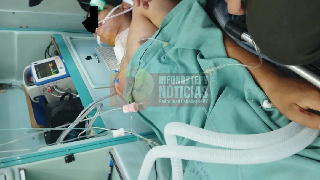 Fallece joven delivery tras ser atropellado y abandonado en Bella Vista Norte