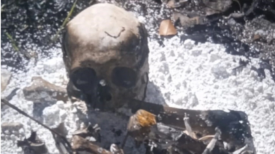Hallan cráneo y otros restos óseos de una persona en Pedro Juan