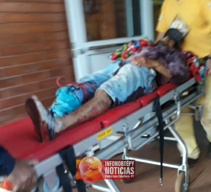 Joven motociclista pierde una pierna en grave accidente en Pedro Juan.