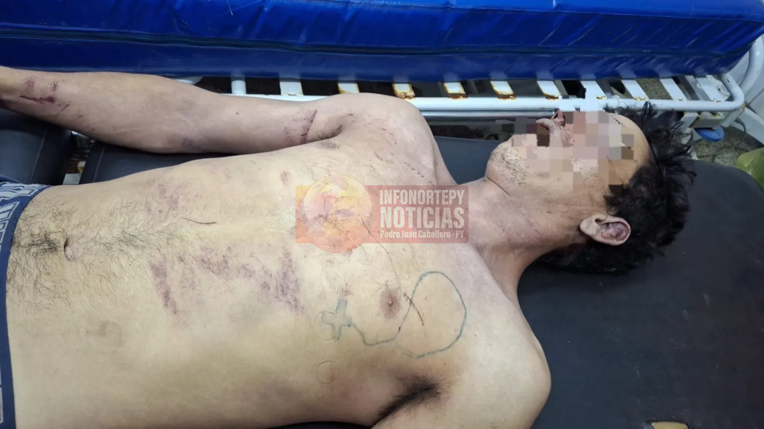 Joven con frondosos antecedentes muere tras caer de un techo durante intento de hurto en Pedro Juan