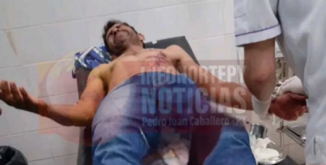 Víctima de tentativa de homicidio se encuentra estable en Capitán Bado