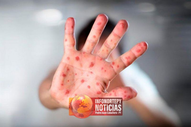 Salud lanza campaña de vacunación contra el sarampión, polio y rubéola
