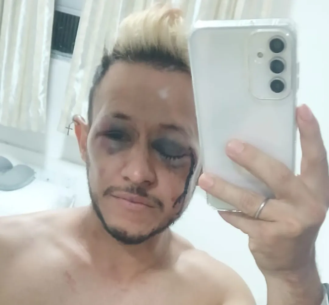 Personal Trainer Denuncia Ataque Homofóbico en Playa Brasileña