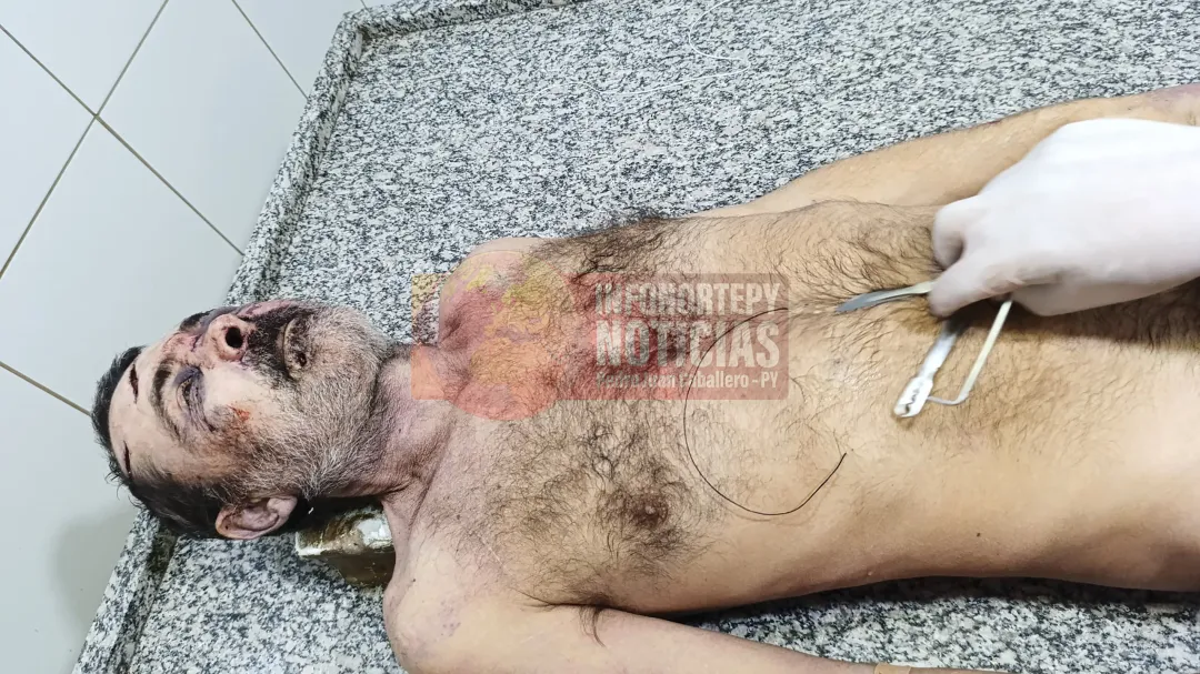 Hombre muere tras ser atacado con arma blanca en Pedro Juan