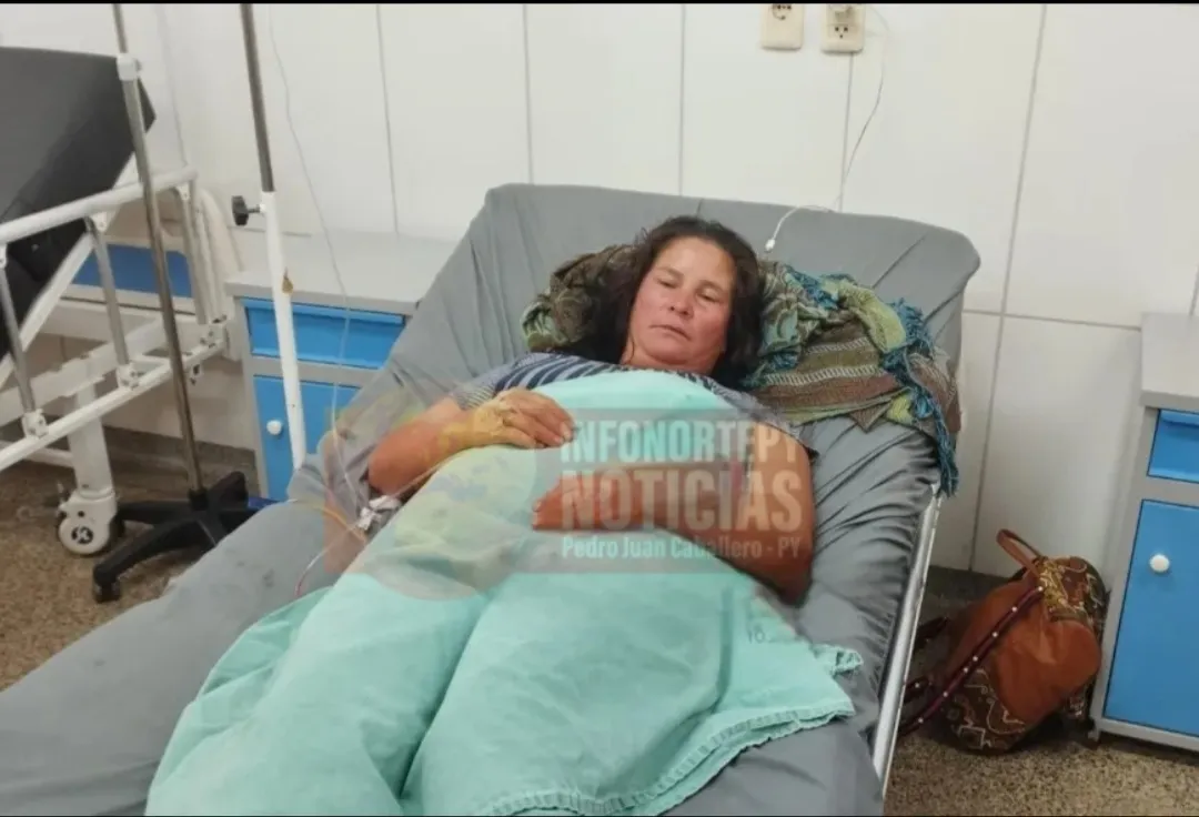 Mujer es mordida por serpiente en el patio de su casa en Pedro Juan