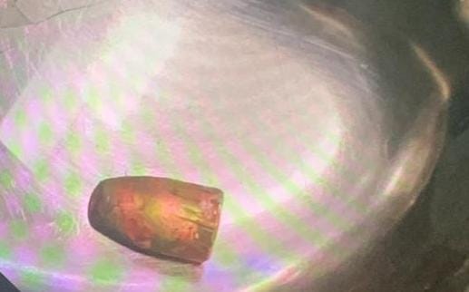 Retiran con éxito proyetil de la cabeza Ruhama