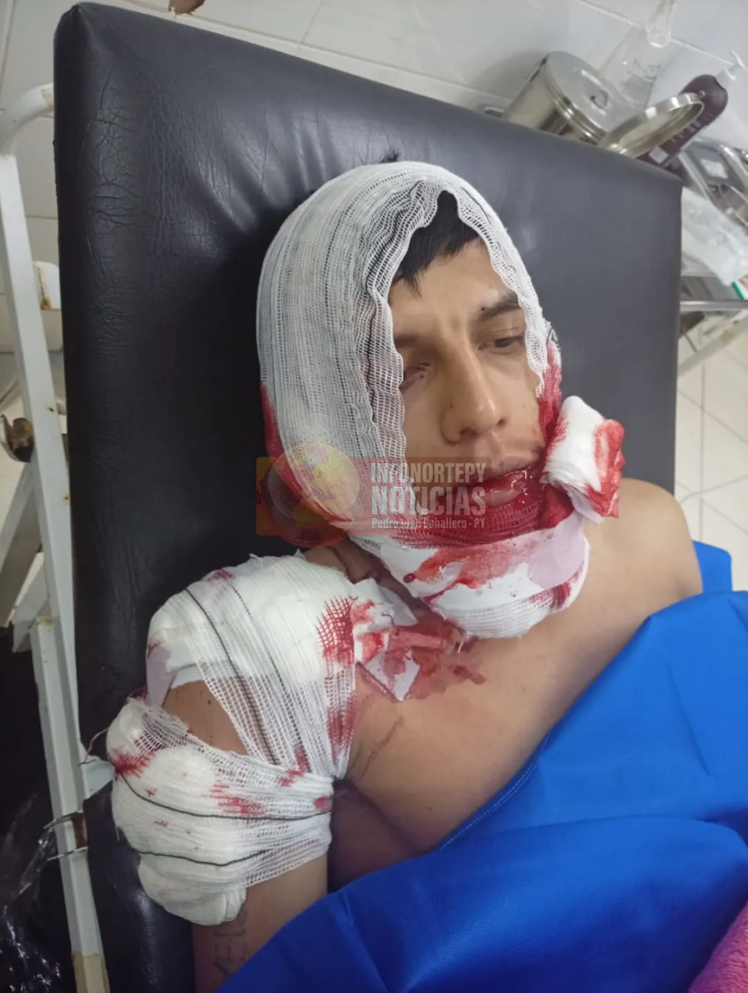 Hirió a su cuñado con disparos de escopeta en zona de Capitán Bado