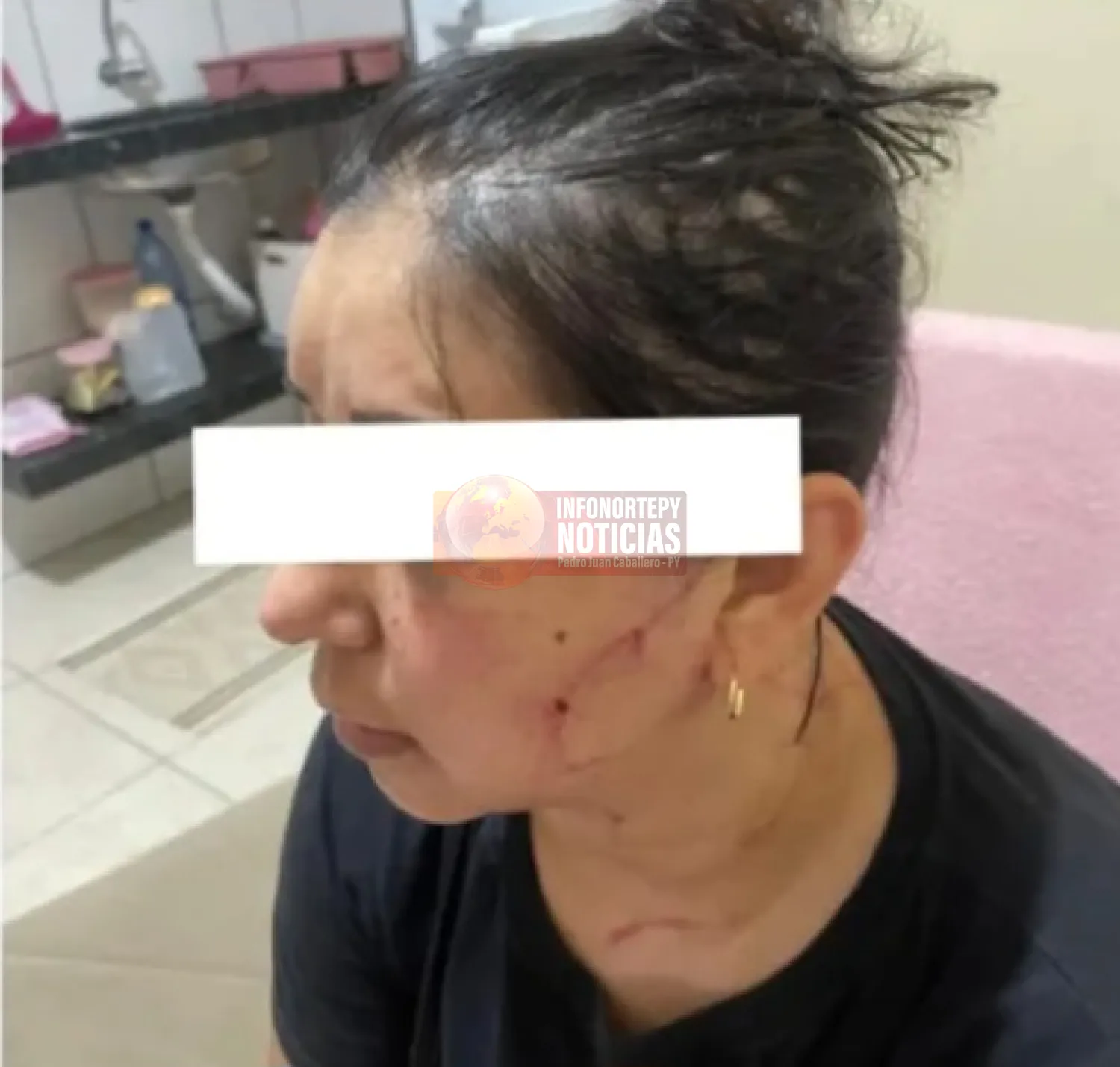 Brutal agresión familiar deja a mujer y niños traumatizados en Pedro Juan