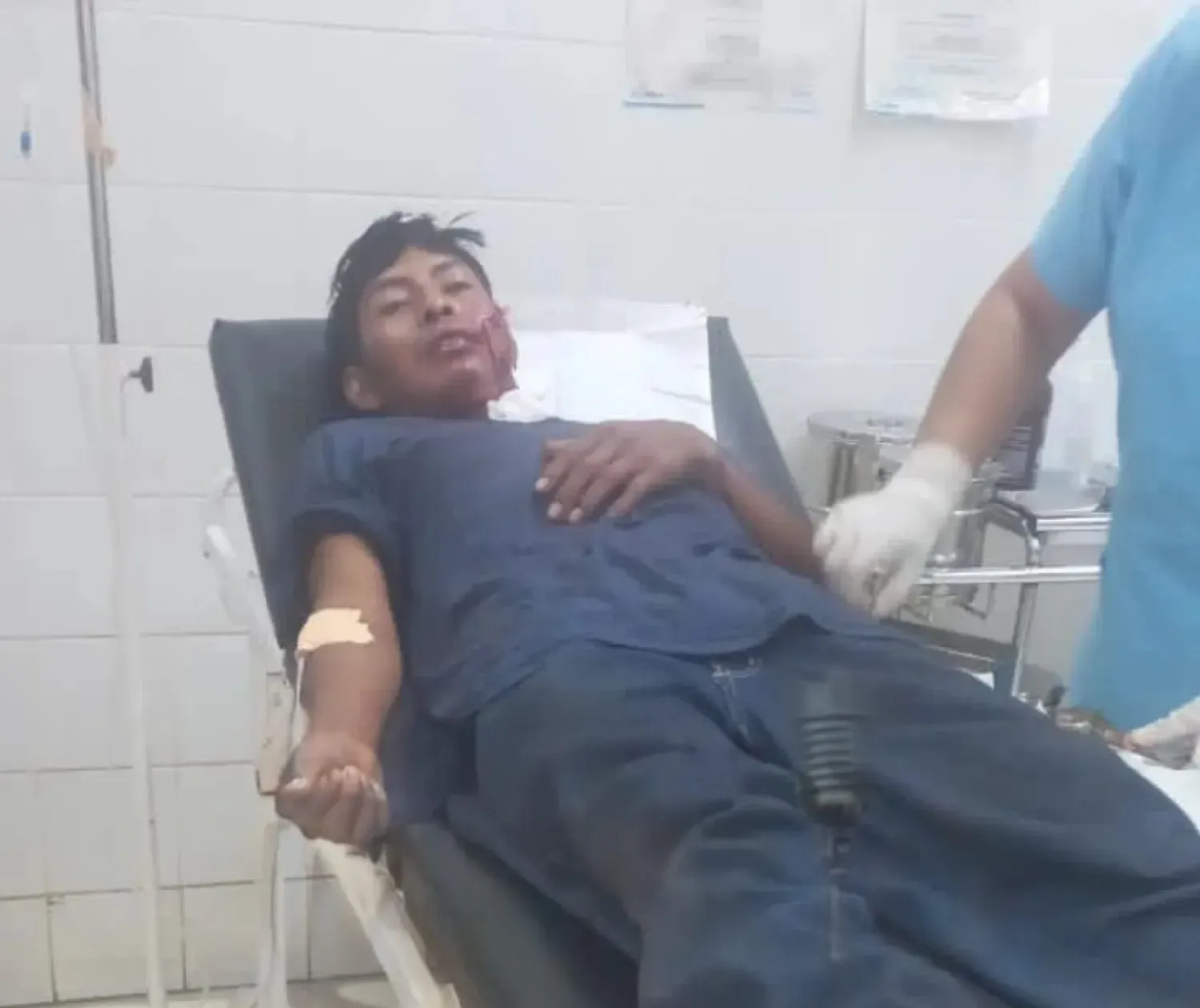 Hombre indígena resulta gravemente herido tras ataque con arma blanca en zona de Capitán Bado