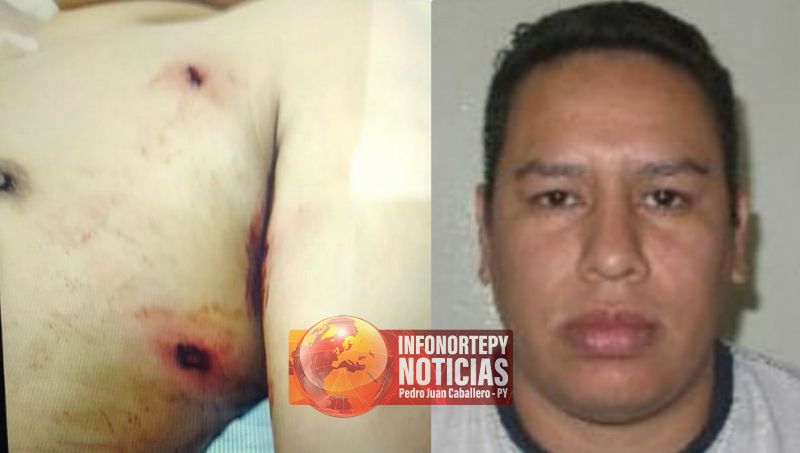 Un hombre herido logró escapar de sicarios en Pedro Juan