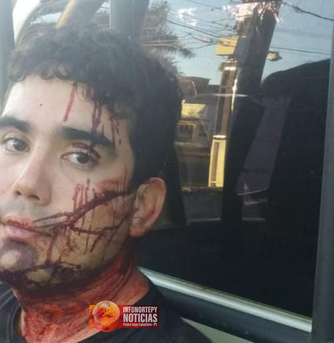 Hombre aplica siete puñaladas a mujer en Pedro Juan