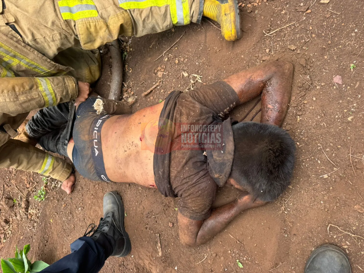 Joven resulta gravemente herido tras ataque con arma blanca en asentamiento de Pedro Juan