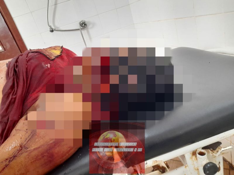 Mujer  falleció tras ser víctima de varias heridas de arma blanca en Cápitan Bado