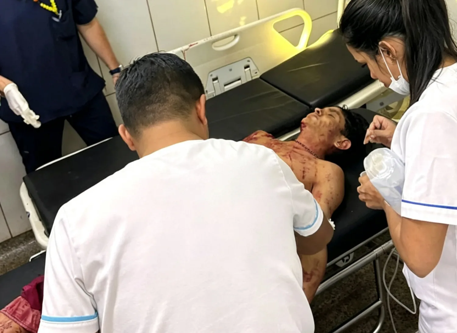 Joven indígena fue herido por su padre al intentar defender a su hermana en Pedro Juan