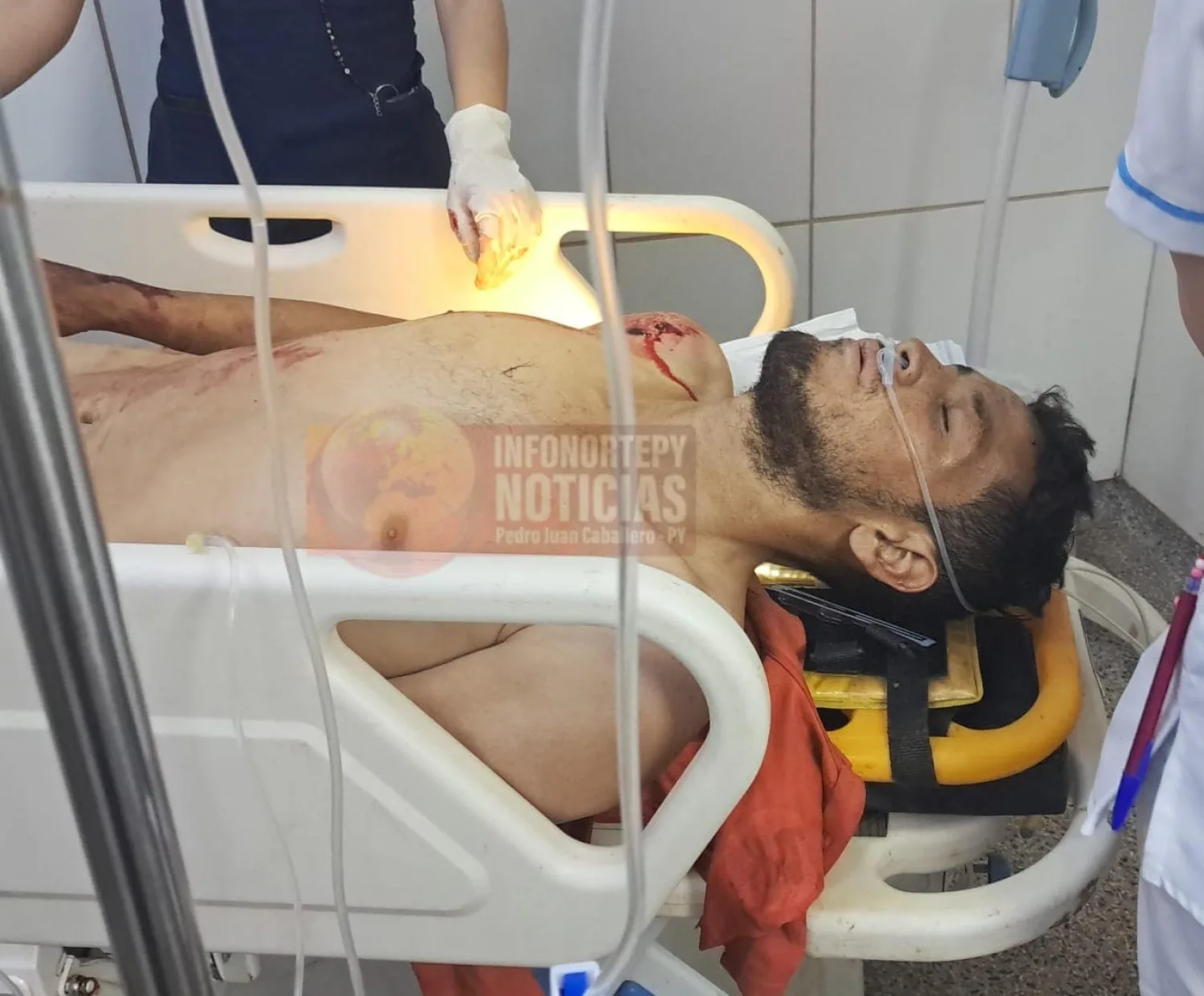 Atacan a tiros a un mecánico en zona rural de Zanja Pytã