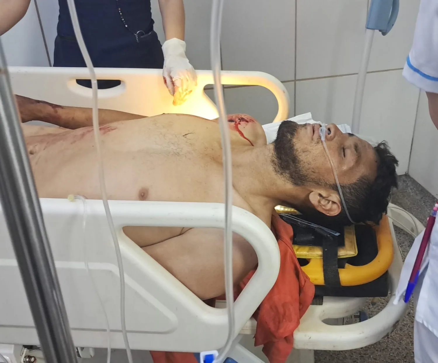 Dan de alta a víctima de intento de homicidio ocurrido en Potrero Sur