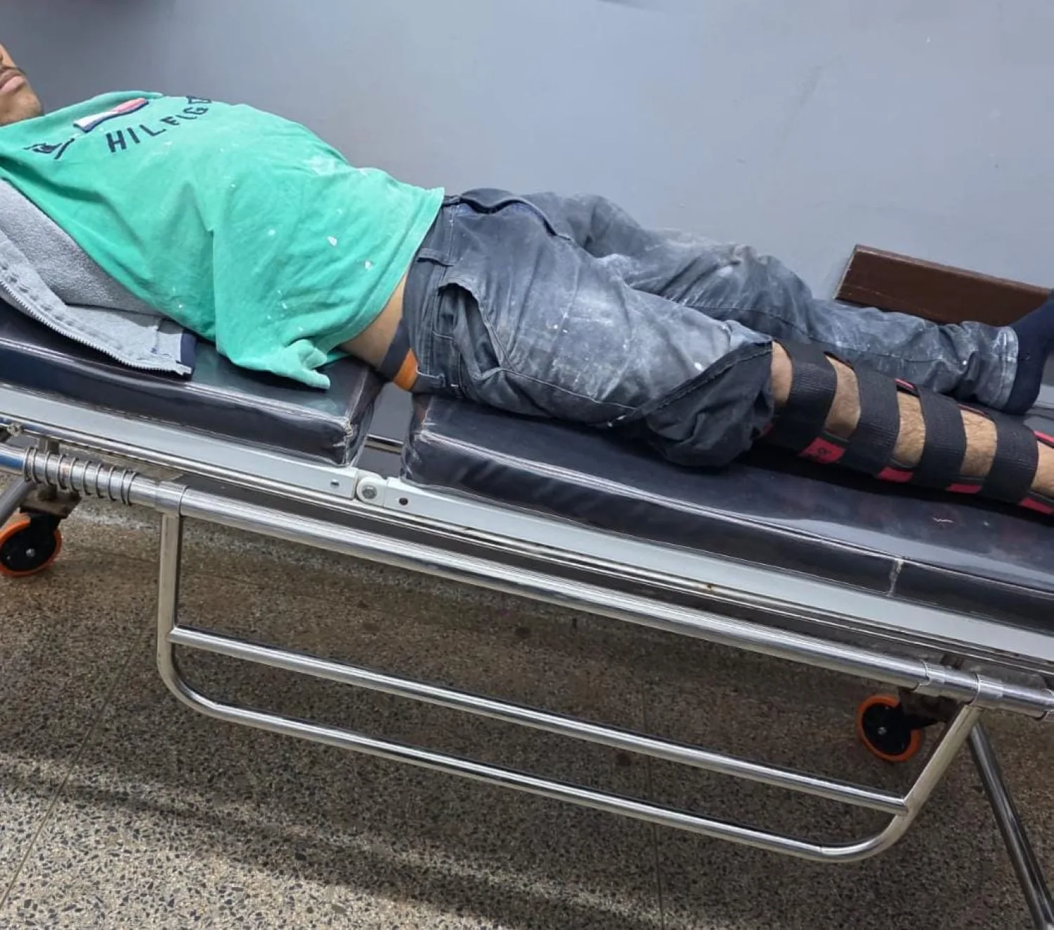 Adolescente sufre fractura tras chocar contra un automóvil en Pedro Juan