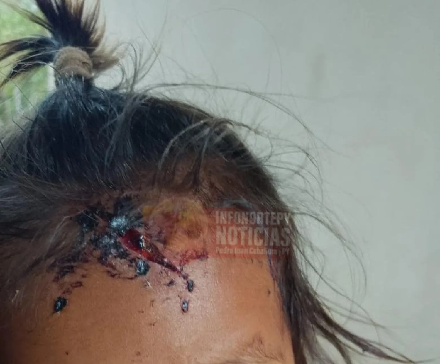 Aprehenden a un hombre tras resultar herida su hija de un año en Cerro Corá