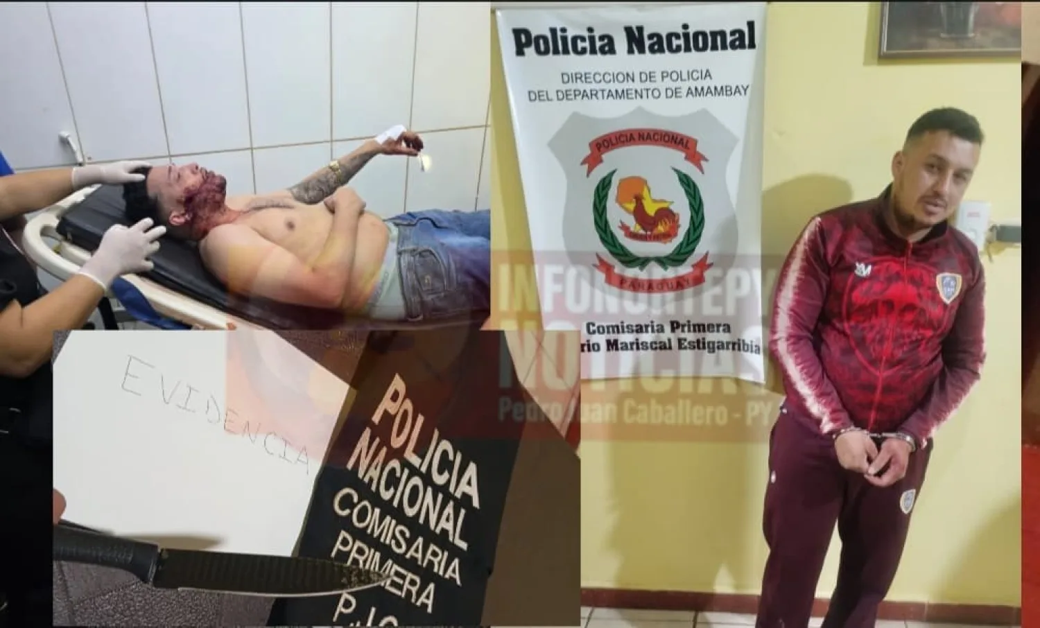 Le cortó la cara a su hermano con un filoso cuchillo en Pedro Juan