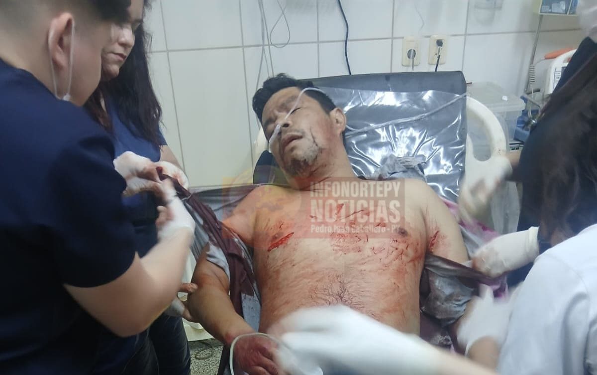 Por celos, apuñaló a un hombre que se encontraba en la casa de su expareja en Pedro Juan