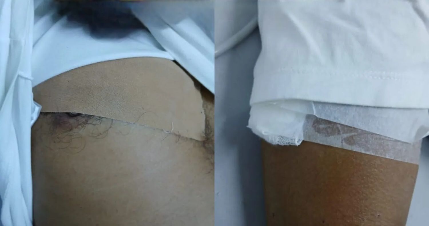 Hombre resulta herido con arma blanca en presunto caso de violencia familiar en Cerro Corá