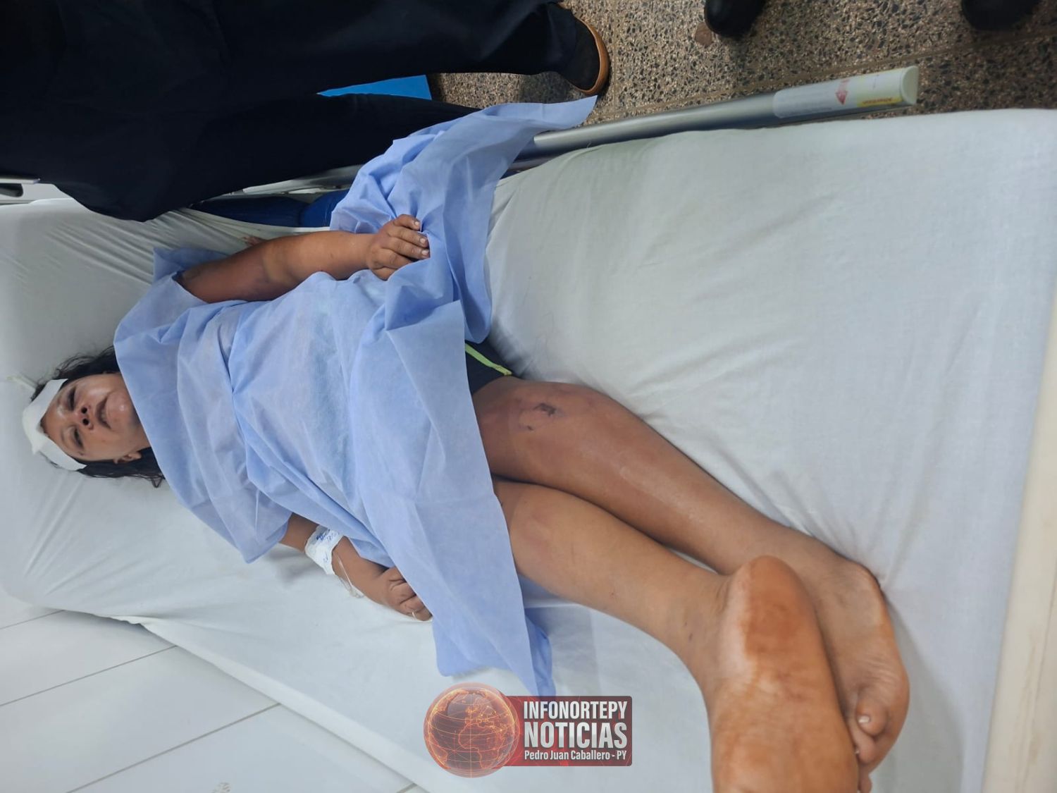 Mujer recibe brutal golpiza en Ponta Porã y es internada en el Hospital Regional de Pedro Juan
