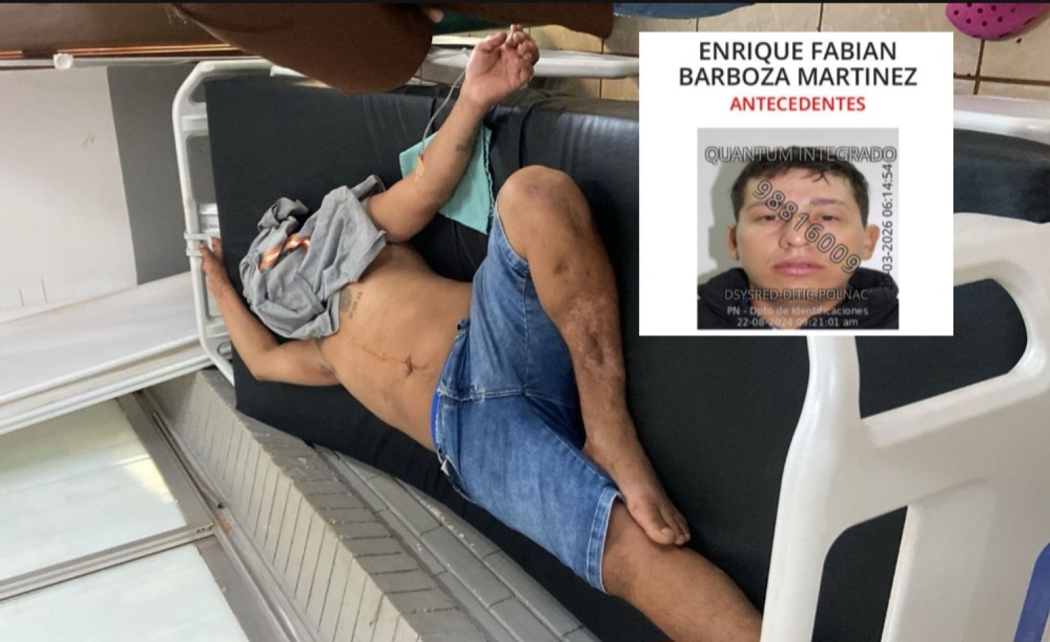 PJC: Hombre llega herido al Hospital Regional y afirma haber sido víctima de intento de asalto
