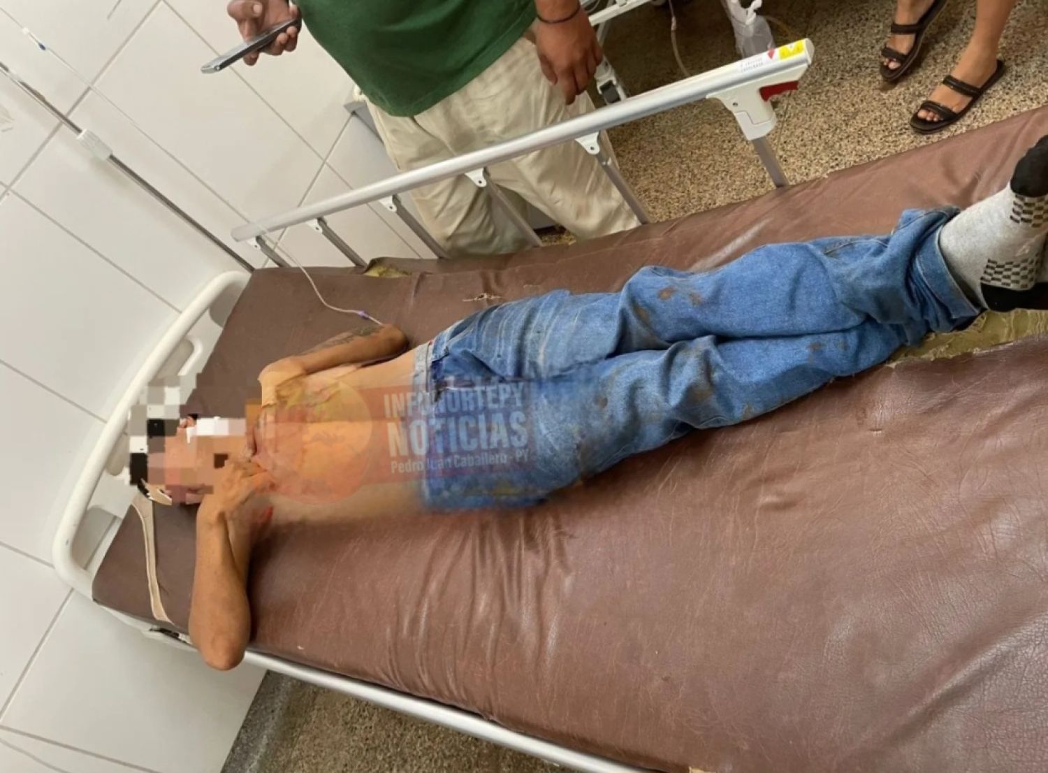 Joven ingresó al Hospital Regional de Pedro Juan con herida de bala en el cuello